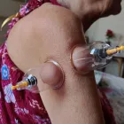 Imagem 2 da empresa ACUPUNTURA BRENO DE MAGALHÃES Medicina e Saúde em Rio De Janeiro RJ