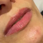 Imagem 2 da empresa AS ALMEIDAS PODOLOGIA/ESTÉTICA FACIAL Clínicas de Podologia em Rio De Janeiro RJ