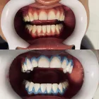 Imagem 2 da empresa CLÍNICA DENTÁRIA SANTA HELENA - CLINICA ODONTOLÓGICA, DENTISTA, MELHOR PERIODONTISTA, PRÓTESE DENTÁRIA Dentistas em Sete Lagoas MG