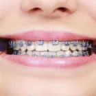 Imagem 4 da empresa CLÍNICA DENTÁRIA SANTA HELENA - CLINICA ODONTOLÓGICA, DENTISTA, MELHOR PERIODONTISTA, PRÓTESE DENTÁRIA Dentistas em Sete Lagoas MG