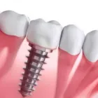 Imagem 6 da empresa CLÍNICA DENTÁRIA SANTA HELENA - CLINICA ODONTOLÓGICA, DENTISTA, MELHOR PERIODONTISTA, PRÓTESE DENTÁRIA Dentistas em Sete Lagoas MG