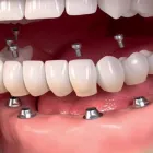 Imagem 4 da empresa DR LUIZ LEOPOLDO BARRETO DE SOUZA-DENTISTA Especialista em Endodontia em São Paulo SP
