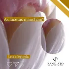 Imagem 3 da empresa ZANELATO ESTÉTICA DENTAL | TRATAMENTOS ODONTOLÓGICOS E ODONTOLOGIA DIGITAL Dentistas em Vitória ES