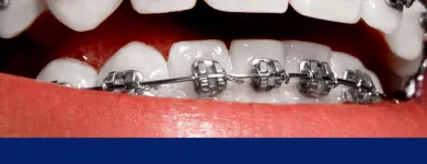 Imagem 2 da empresa DENTISTA GUARAPARI | CLÍNICA ORTODÔNTICA SIMÕES Dentista - Ortodontia em Guarapari ES