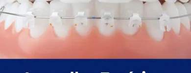 Imagem 3 da empresa DENTISTA GUARAPARI | CLÍNICA ORTODÔNTICA SIMÕES Dentista - Ortodontia em Guarapari ES