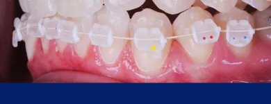 Imagem 4 da empresa DENTISTA GUARAPARI | CLÍNICA ORTODÔNTICA SIMÕES Dentista - Ortodontia em Guarapari ES