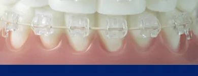 Imagem 5 da empresa DENTISTA GUARAPARI | CLÍNICA ORTODÔNTICA SIMÕES Dentista - Ortodontia em Guarapari ES