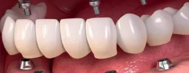 Imagem 4 da empresa DR LUIZ LEOPOLDO BARRETO DE SOUZA-DENTISTA Especialista em Endodontia em São Paulo SP